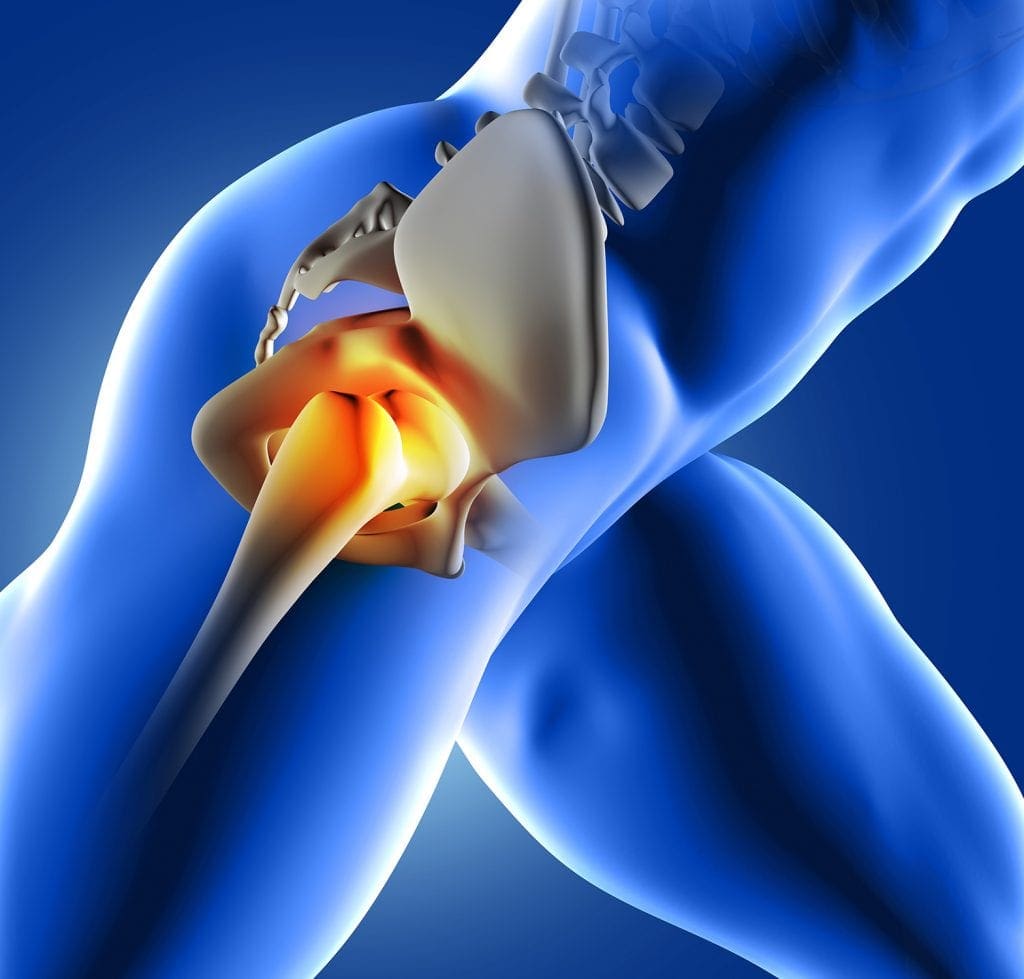 UNDERSTANDING HIP PAIN