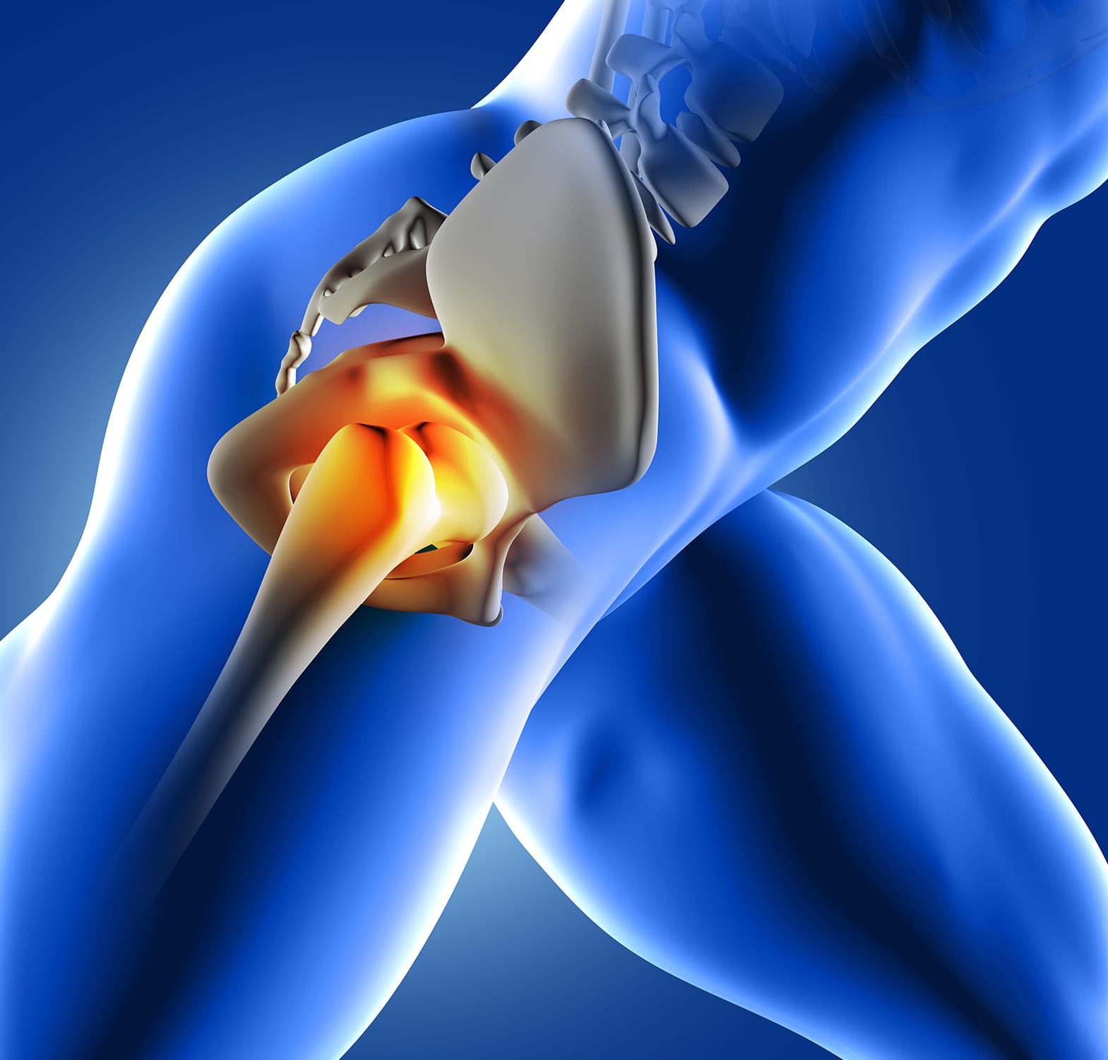 UNDERSTANDING HIP PAIN - Cape Fear Orthopedics & Sports Medicine